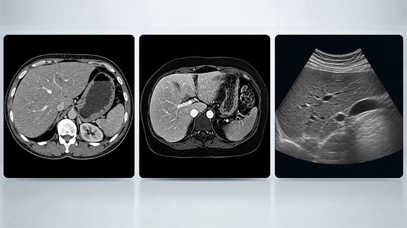 Unterschiedliche Darstellungen der Leber im CT, MRT und Ultraschall