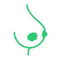 Knoten Mammographie MRT