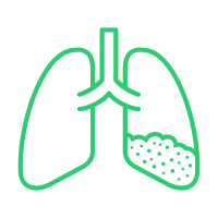 CT Lungenentzündung