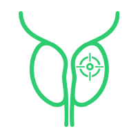 Biopsieplanung Prostata