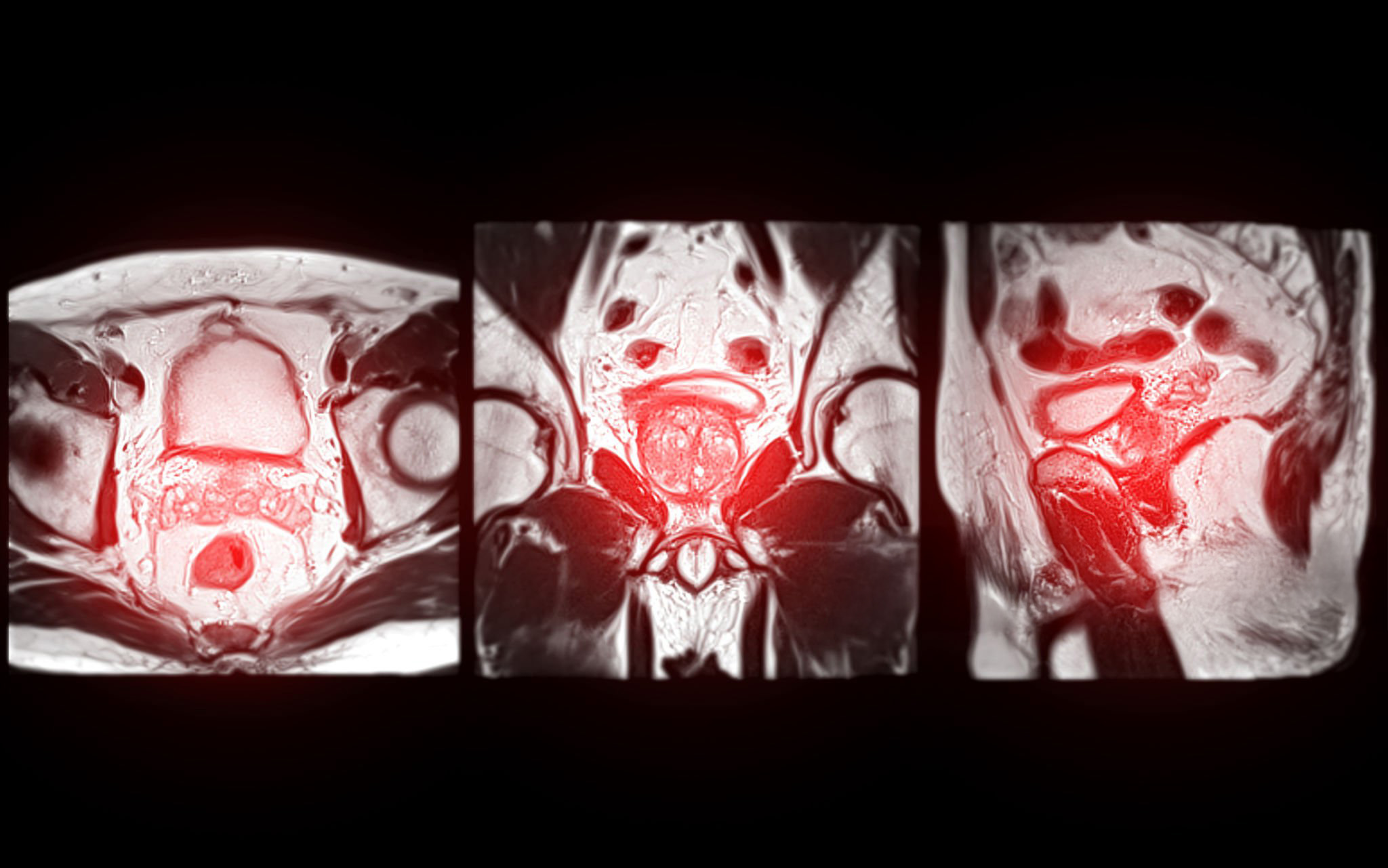 Prostatabildgebung