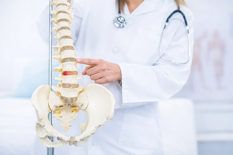 Experten für Rückenschmerzen